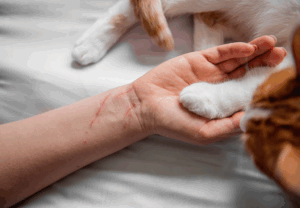 Close-up of a person’s hand with a scratch mark, holding a cat’s paw gently to show accidental scratches.